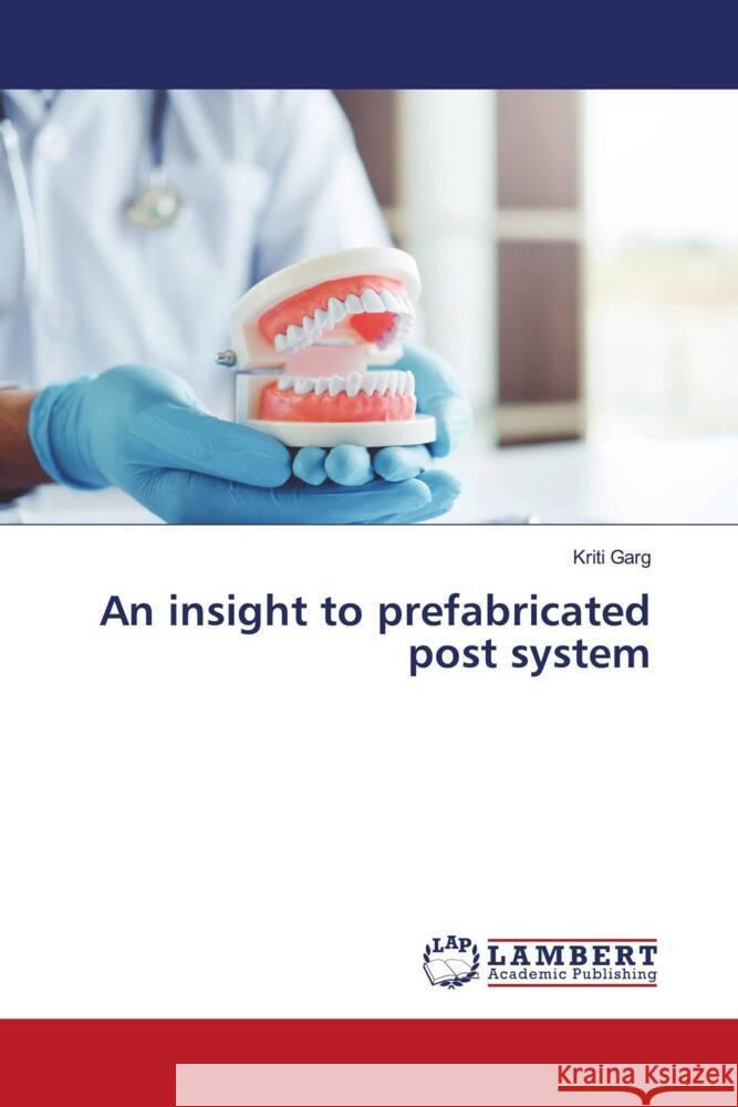 An insight to prefabricated post system Kriti Garg 9786207998869 LAP Lambert Academic Publishing - książka