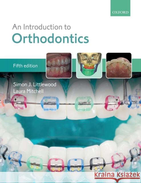 An Introduction to Orthodontics Simon J. Littlewood Laura Mitchell 9780198808664 Oxford University Press - książka