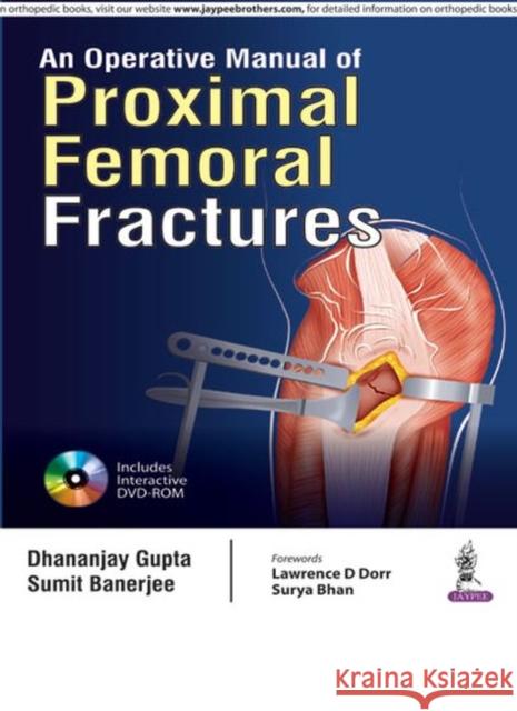 An Operative Manual of Proximal Femoral Fractures Dhananjay Gupta Sumitro Banerjee 9789351524854 Jp Medical Ltd - książka