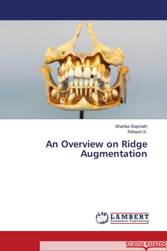 An Overview on Ridge Augmentation Gopinath, Sharika, K., Rithesh 9786204727905 LAP Lambert Academic Publishing - książka