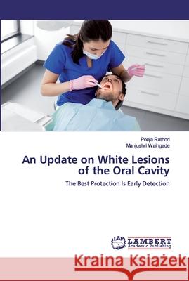 An Update on White Lesions of the Oral Cavity Rathod, Pooja 9786200431189 LAP Lambert Academic Publishing - książka