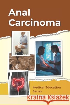 Anal Carcinoma Sabri, S. 9798281661096 Independently Published - książka