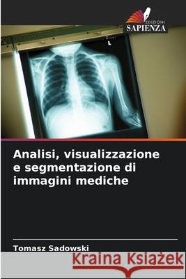 Analisi, visualizzazione e segmentazione di immagini mediche Tomasz Sadowski 9786208918880 Edizioni Sapienza - książka
