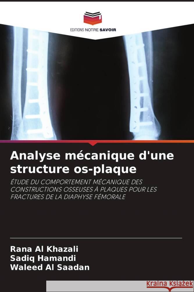 Analyse mécanique d'une structure os-plaque Al Khazali, Rana, Hamandi, Sadiq, Al Saadan, Waleed 9786204555638 Editions Notre Savoir - książka