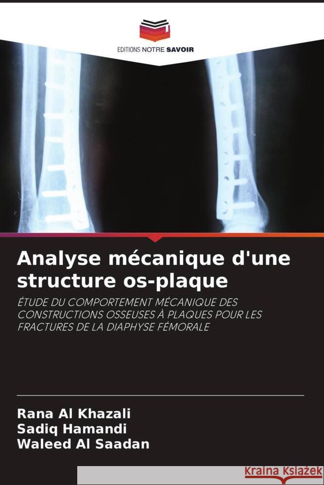 Analyse mécanique d'une structure os-plaque Al Khazali, Rana, Hamandi, Sadiq, Al Saadan, Waleed 9786204555638 Editions Notre Savoir - książka