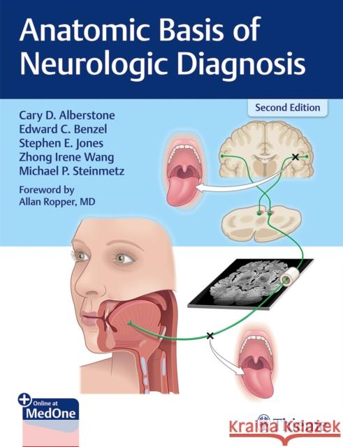 Anatomic Basis of Neurologic Diagnosis Cary Alberstone Edward C. Benzel Michael Steinmetz 9781626237858 Thieme Medical Publishers - książka