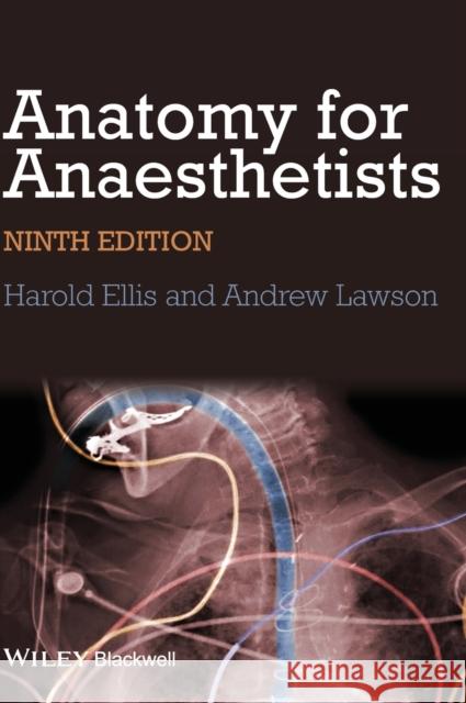 Anatomy for Anaesthetists Harold Ellis Andrew Lawson 9781118375983 Wiley-Blackwell - książka