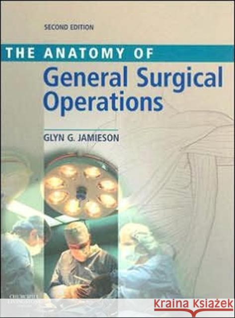 Anatomy of General Surgical Operations Glyn G. Jamieson 9780443100079 Churchill Livingstone - książka