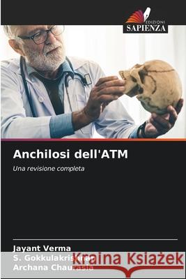 Anchilosi dell'ATM Verma, Jayant, Gokkulakrishnan, S., Chaurasia, Archana 9786200818669 Edizioni Sapienza - książka