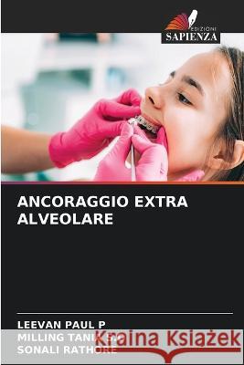 Ancoraggio Extra Alveolare Leevan Paul P Milling Tania S Sonali Rathore 9786205622865 Edizioni Sapienza - książka