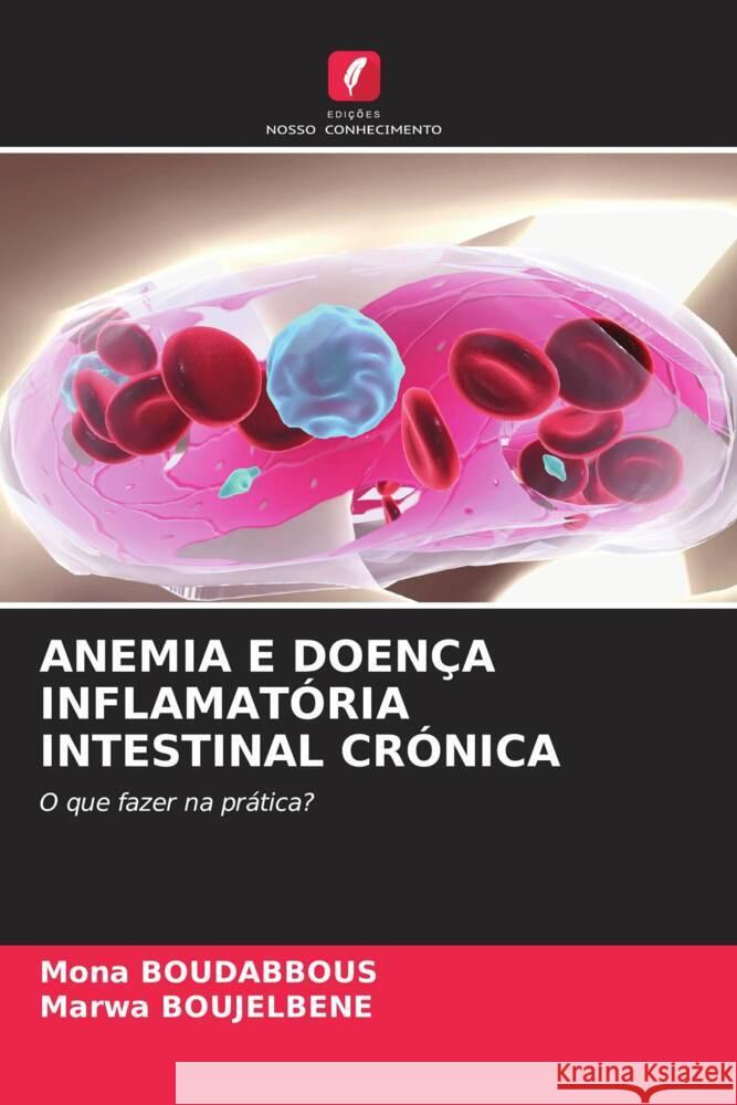 Anemia E Doen?a Inflamat?ria Intestinal Cr?nica Mona Boudabbous Marwa Boujelbene 9786206599272 Edicoes Nosso Conhecimento - książka