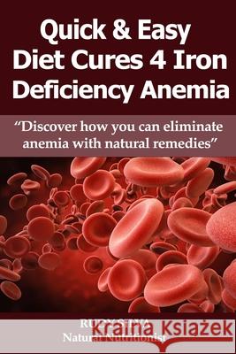 Anemia: Iron Deficiency Diet: Anemia: Iron Deficiency MR Rudy Silva Silva Rudy S. Silva 9781477573143 Createspace - książka