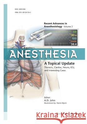Anesthesia: A Topical Update - Thoracic, Cardiac, Neuro, ICU, and Interesting Cases John, Amballur D. 9781681087245 Bentham Science Publishers - książka