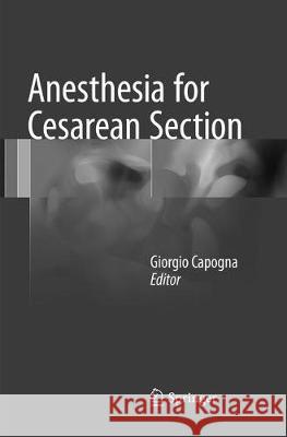 Anesthesia for Cesarean Section Giorgio Capogna 9783319824895 Springer - książka