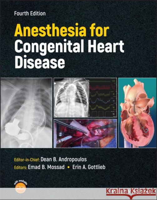 Anesthesia for Congenital Heart Disease Andropoulos, Dean B. 9781119791652 John Wiley and Sons Ltd - książka