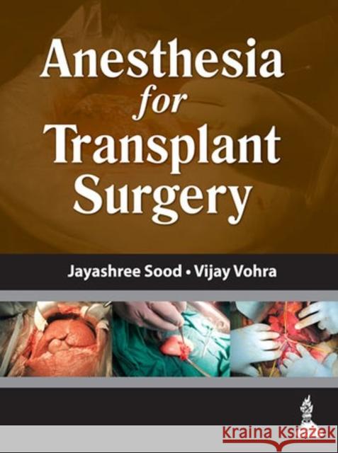 Anesthesia for Transplant Surgery Jayashree Sood 9789351521396 JP Medical Ltd - książka