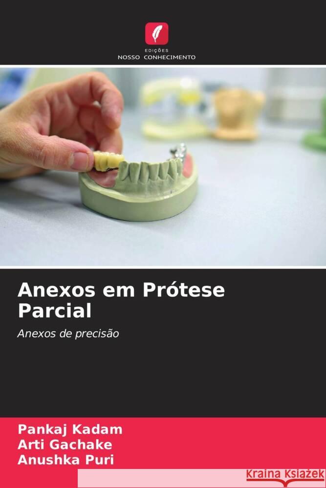 Anexos em Prótese Parcial Kadam, Pankaj, GACHAKE, ARTI, PURI, ANUSHKA 9786205162347 Edições Nosso Conhecimento - książka