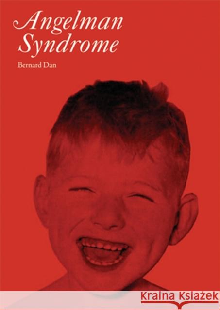 Angelman Syndrome Bernard Dan 9781898683551 Mac Keith Press - książka