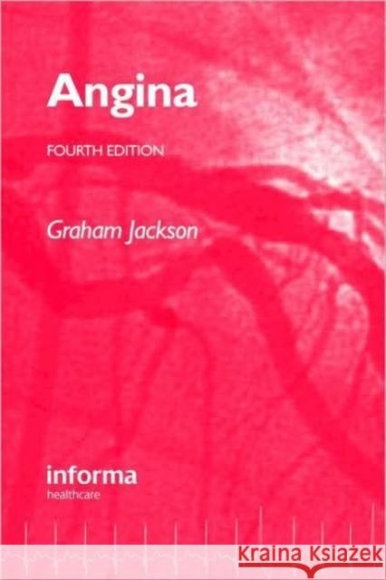 Angina Jackson, Graham 9781841846699  - książka