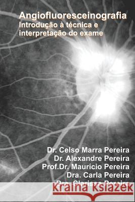 Angiofluoresceinografia: Introdução a Interpretação do Exame Celso Pereira, Maurício Pereira, Carla Pereira 9798477629480 Independently Published - książka