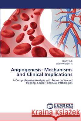 Angiogenesis: Mechanisms and Clinical Implications S, AMUTHA, R, SELVAKUMAR 9786207476855 LAP Lambert Academic Publishing - książka