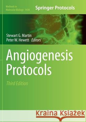 Angiogenesis Protocols Stewart G. Martin Peter W. Hewett 9781493980994 Humana Press - książka