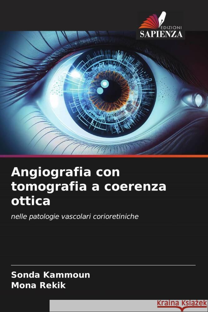 Angiografia con tomografia a coerenza ottica Sonda Kammoun Mona Rekik 9786208276089 Edizioni Sapienza - książka