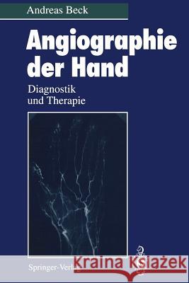 Angiographie Der Hand: Diagnostik Und Therapie Beck, Andreas 9783642789243 Springer - książka