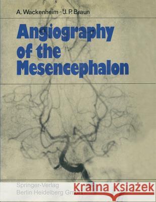 Angiography of the Mesencephalon: Normal and Pathological Findings Wackenheim, Auguste 9783662278826 Springer - książka