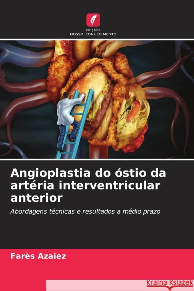 Angioplastia do óstio da artéria interventricular anterior Azaiez, Farès 9786208177300 Edições Nosso Conhecimento - książka