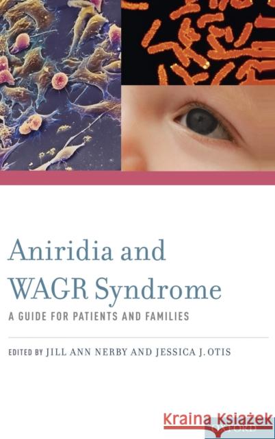 aniridia and wagr syndrome  Nerby 9780195389302 Oxford University Press, USA - książka