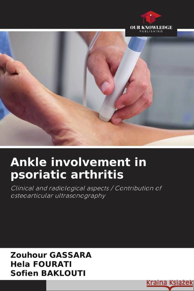 Ankle involvement in psoriatic arthritis Gassara, Zouhour, Fourati, Hela, Baklouti, Sofien 9786208546380 Our Knowledge Publishing - książka