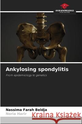 Ankylosing spondylitis Beldja, Nassima Farah, Harir, Noria 9786209580413 Our Knowledge Publishing - książka