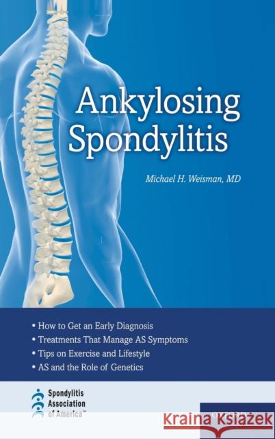 Ankylosing Spondylitis C Weisman, Michael H. 9780195399103 Oxford University Press, USA - książka