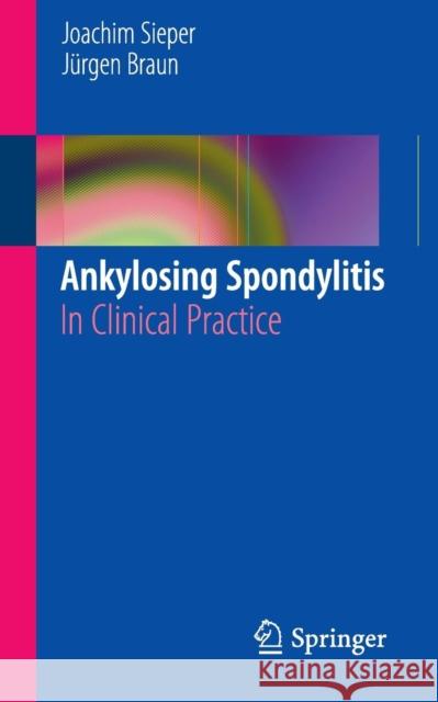 Ankylosing Spondylitis: In Clinical Practice Sieper, Joachim 9780857291790  - książka