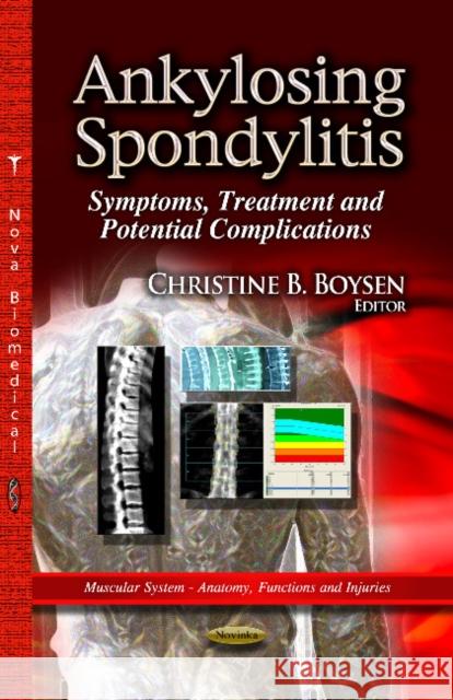 Ankylosing Spondylitis: Symptoms, Treatment & Potential Complications Christine B Boysen 9781626183612 Nova Science Publishers Inc - książka