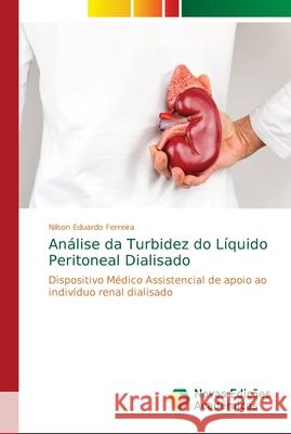 Análise da Turbidez do Líquido Peritoneal Dialisado Ferreira, Nilson Eduardo 9786139627141 Novas Edicioes Academicas - książka