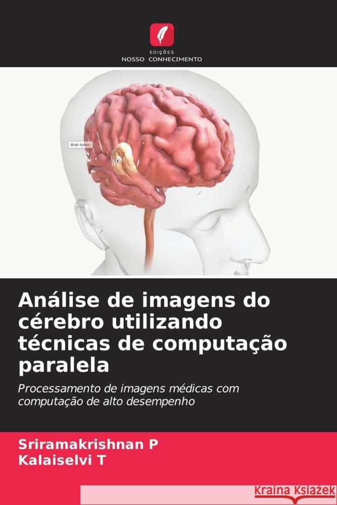 An?lise de imagens do c?rebro utilizando t?cnicas de computa??o paralela Sriramakrishnan P Kalaiselvi T 9786207281152 Edicoes Nosso Conhecimento - książka