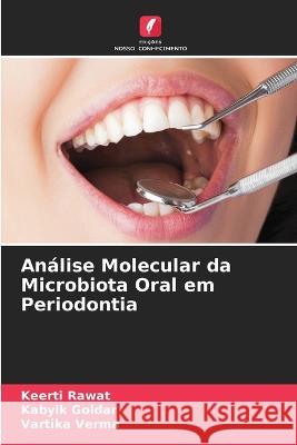 An?lise Molecular da Microbiota Oral em Periodontia Keerti Rawat Kabyik Goldar Vartika Verma 9786205877784 Edicoes Nosso Conhecimento - książka