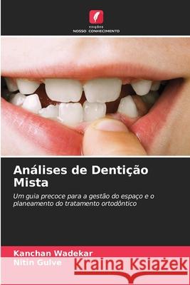 An?lises de Denti??o Mista Kanchan Wadekar Nitin Gulve 9786207710201 Edicoes Nosso Conhecimento - książka