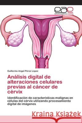 Análisis digital de alteraciones celulares previas al cáncer de cérvix Pérez López, Guillermo Angel 9783659064050 Editorial Acad Mica Espa Ola - książka