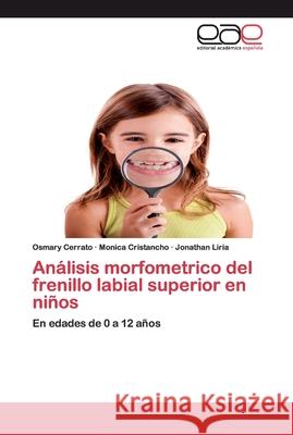 Análisis morfometrico del frenillo labial superior en niños Cerrato, Osmary 9786202235495 Editorial Académica Española - książka