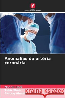 Anomalias da art?ria coron?ria Noorul Hadi Tahir Shah Farooq Ahmad 9786207914135 Edicoes Nosso Conhecimento - książka