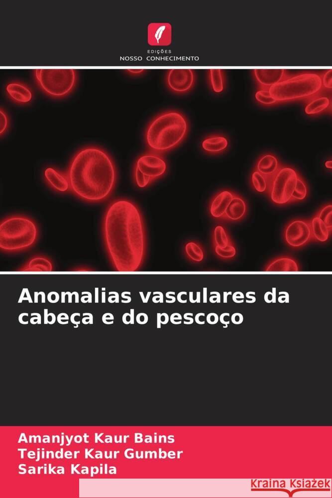 Anomalias vasculares da cabeça e do pescoço Bains, Amanjyot Kaur, Gumber, Tejinder Kaur, Kapila, Sarika 9786204931593 Edições Nosso Conhecimento - książka