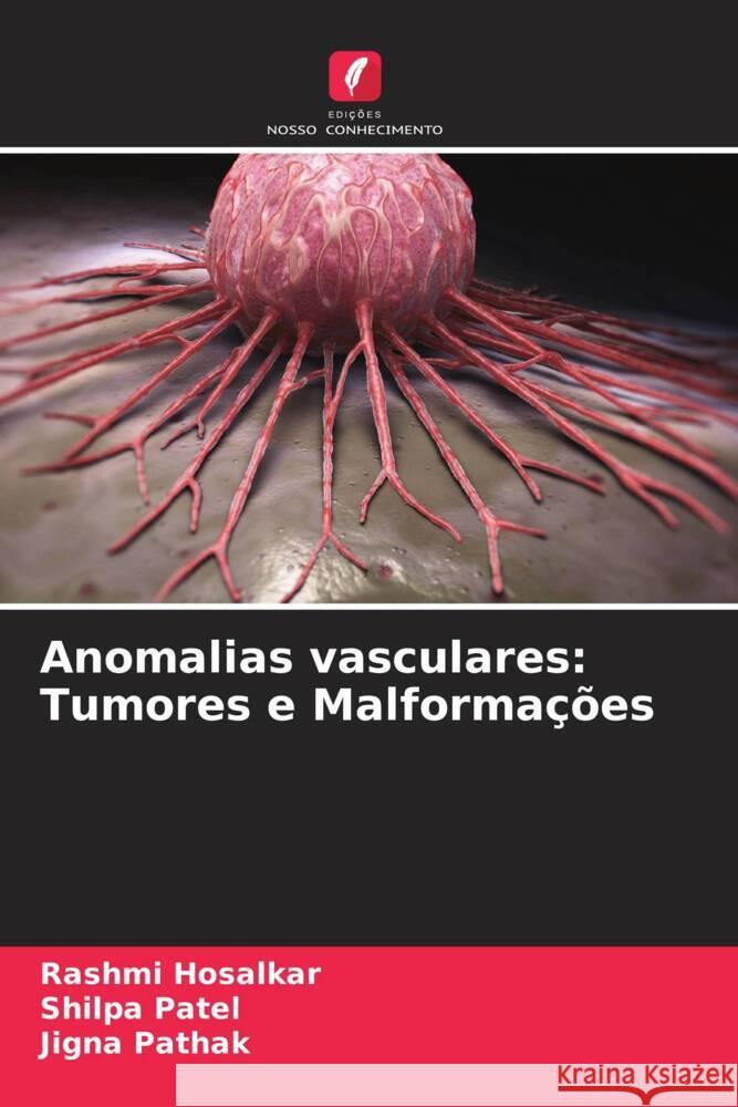 Anomalias vasculares: Tumores e Malforma??es Rashmi Hosalkar Shilpa Patel Jigna Pathak 9786206934677 Edicoes Nosso Conhecimento - książka