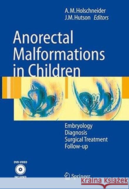 Anorectal Malformations in Children: Embryology, Diagnosis, Surgical Treatment, Follow-Up Holschneider, Alexander Matthias 9783662517888 Springer - książka