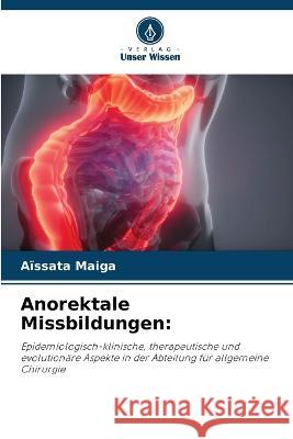 Anorektale Missbildungen Aïssata Maiga 9786205354506 Verlag Unser Wissen - książka