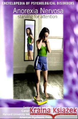 Anorexia Nervosa Daniel E. Harmon   9780791049013 Chelsea House Publishers - książka