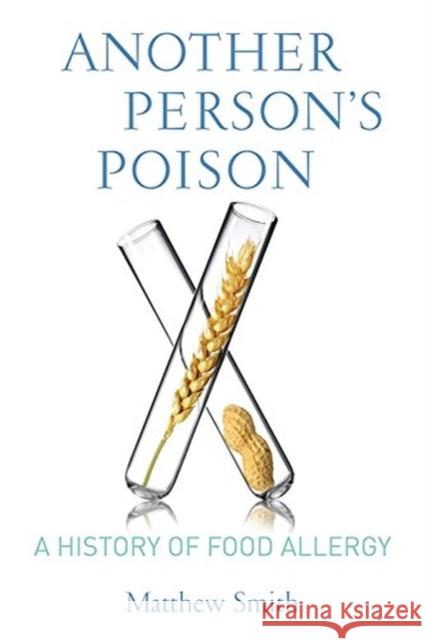 Another Person's Poison: A History of Food Allergy Smith, Matthew 9780231164856 John Wiley & Sons - książka