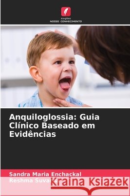 Anquiloglossia: Guia Cl?nico Baseado em Evid?ncias Sandra Maria Enchackal Reshma Suvarna 9786209397318 Edicoes Nosso Conhecimento - książka